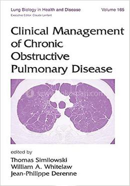 Clinical Management of Chronic Obstructive Pulmonary Disease image