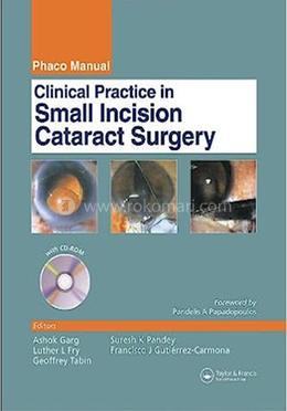 Clinical Practice in Small Incision Cataract Surgery image