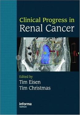 Clinical Progress in Renal Cancer image