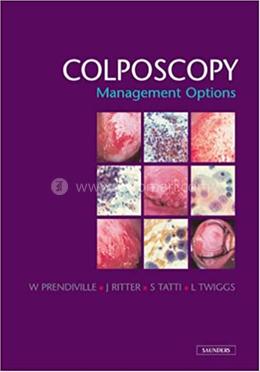 Colposcopy: Management Options image