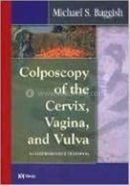 Colposcopy of the Cervix, Vagina, and Vulva image