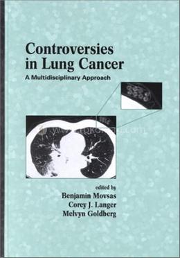 Controversies in Lung Cancer image