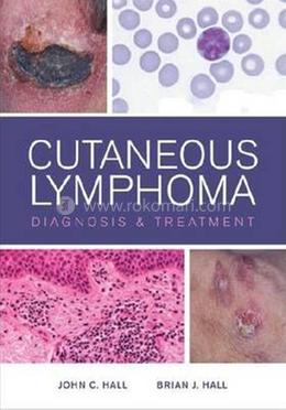 Cutaneous Lymphoma Diagnosis And Treatmnet (Hb 2012) image