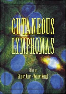 Cutaneous Lymphomas image