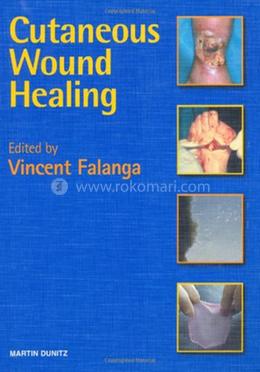 Cutaneous Wound Healing image