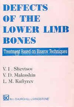 Defects Of The Lower Limb Bones image