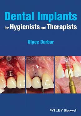 Dental Implants for Hygienists and Therapists image