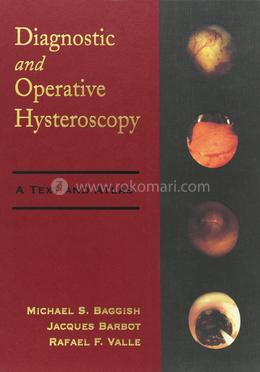 Diagnostic and Operative Hysteroscopy: A Text and Atlas image