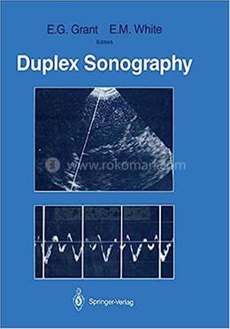 Duplex Sonography image