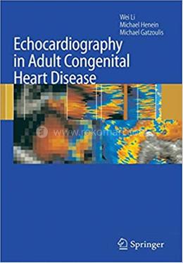 Echocardiography in Adult Congenital Heart Disease image