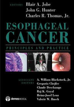 Esophageal Cancer image