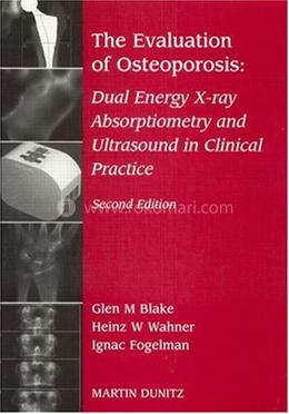 Evaluation Of Osteoporosis image