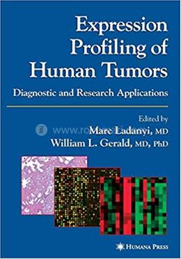 Expression Profiling of Human Tumors image