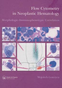 Flow Cytometry in Neoplastic Hematology image