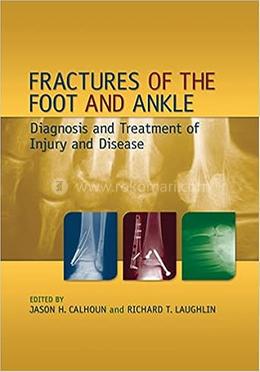 Fractures of the Foot and Ankle image