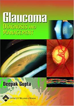 Glaucoma Diagnosis and Management image