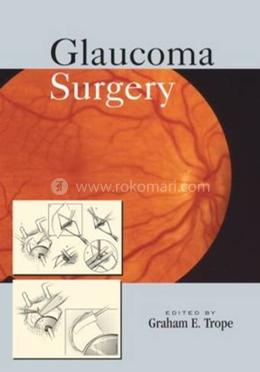 Glaucoma Surgery image