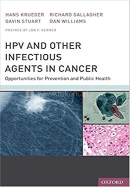 HPV and Other Infectious Agents in Cancer image