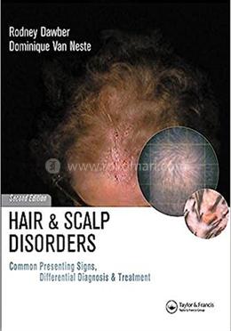 Hair and Scalp Disorders image