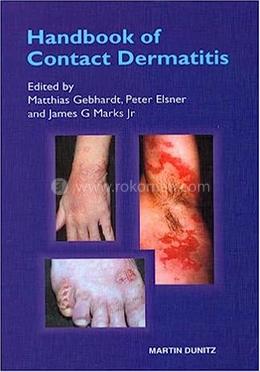 Handbook of Contact Dermatitis image