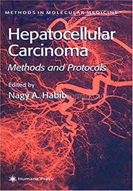 Hepatocellular Carcinoma image