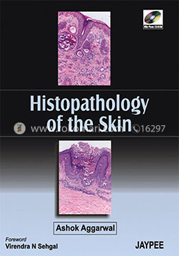 Histopathology of the Skin image