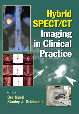 Hybrid SPECT/CT Imaging in Clinical Practice image