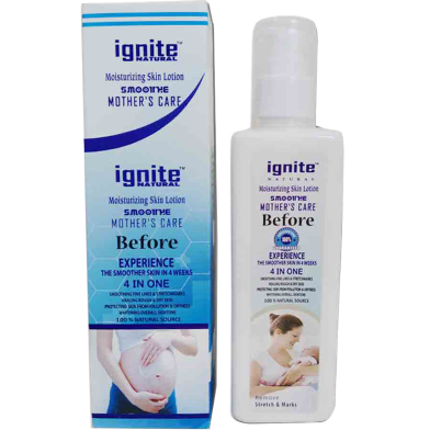Ignite Mother Care Lotion - 100 ml image