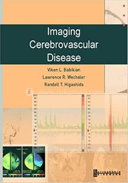 Imaging Cerebrovascular Disease image