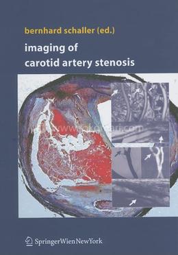 Imaging of Carotid Artery Stenosis image