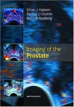 Imaging of the Prostate