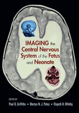 Imaging the Central Nervous System of the Fetus and Neonate image