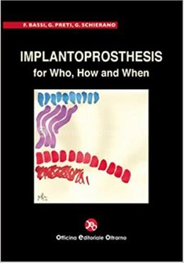 Implantoprosthesis For Who, How And When image