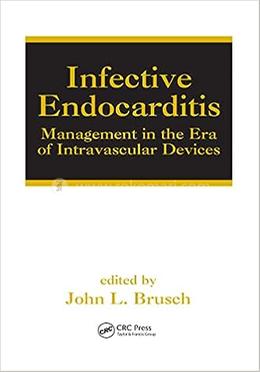 Infective Endocarditis