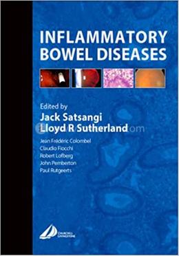 Inflammatory Bowel Diseases