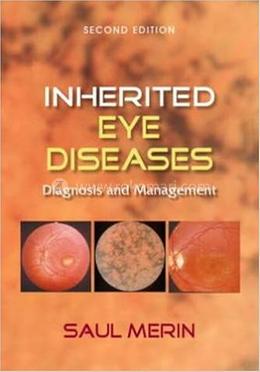 Inherited Eye Diseases image