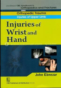 Injuries of Wrist and Hand - (Handbooks in Orthopedics and Fractures Series, Vol. 9 : Orthopedic Trauma Injuries of Upper Limb) image