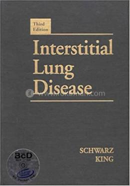 Interstitial Lung Disease