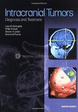 Intracranial Tumors: Diagnosis and Treatment image