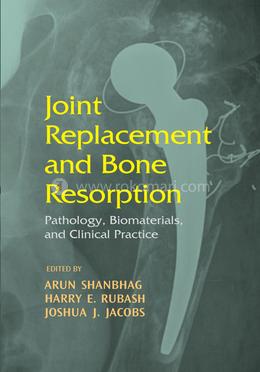 Joint Replacement and Bone Resorption image