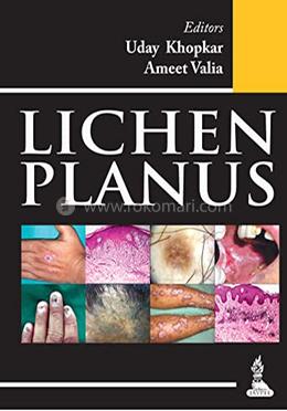 Lichen Planus image