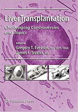 Liver Transplantation - Clinical Gastroenterology image