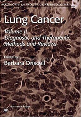 Lung Cancer image