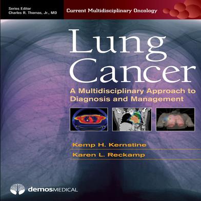 Lung Cancer: A Multidisciplinary Approach to Diagnosis and Management image