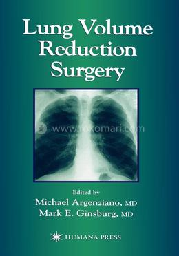 Lung Volume Reduction Surgery image