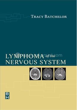 Lymphoma of the Nervous System image