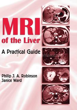 MRI of the Liver image