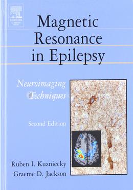 Magnetic Resonance in Epilepsy image