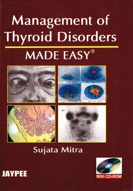 Management Of Thyroid Disorders Made Easy image
