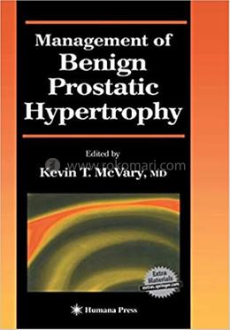 Management of Benign Prostatic Hypertrophy image
